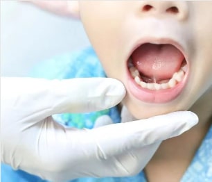Hamilton children's dentist checking young boy's mouth before tongue tie procedure