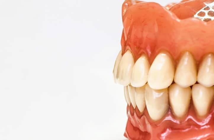 Model of teeth and gums affected by gum disease